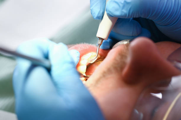 Best Emergency Dental Care for Abscessed Tooth in Dillingham, AK